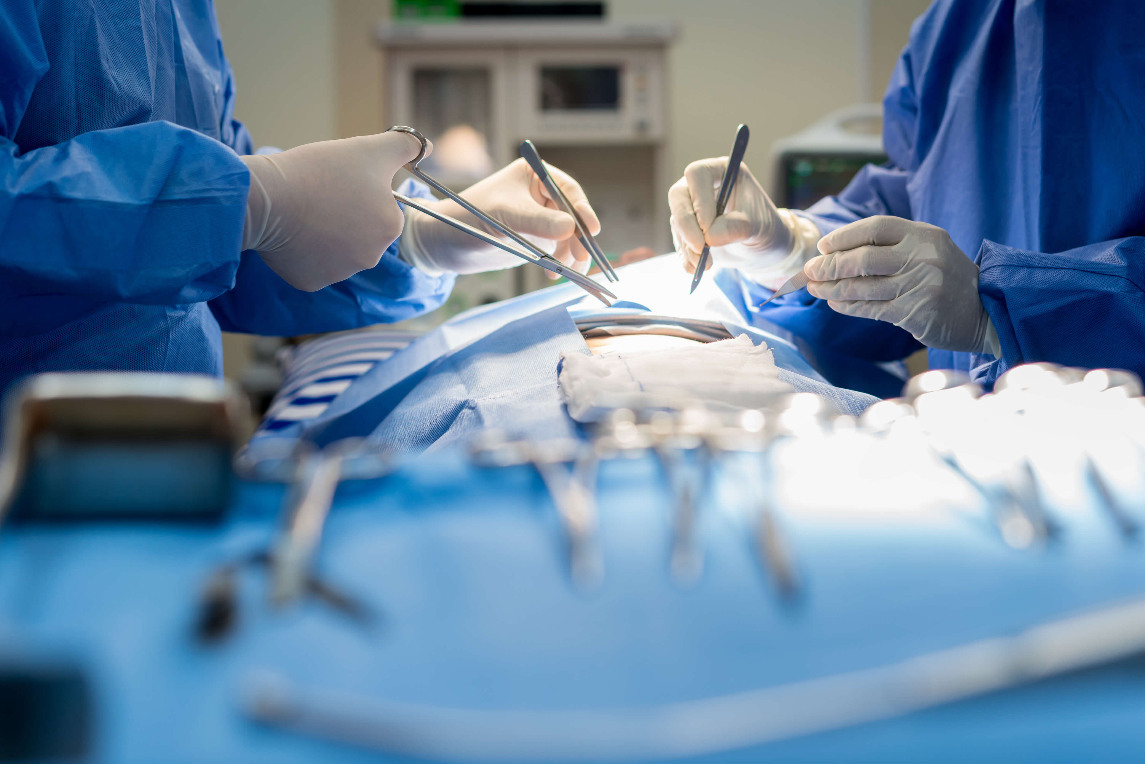 Surgeons using a surgical stapler during a procedure.