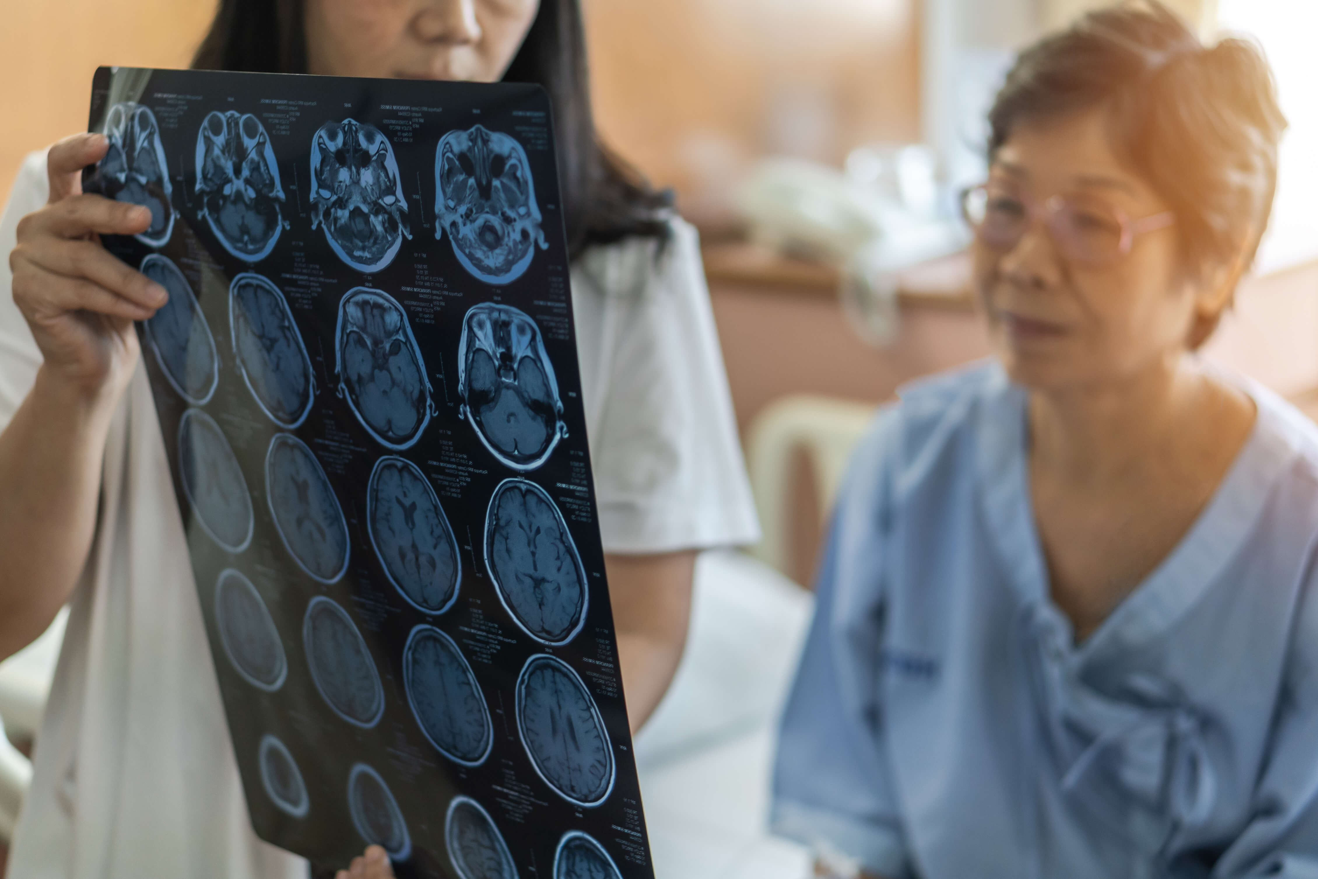 X-rays showing traumatic brain injury symptoms.