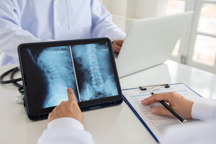 Doctor holding spinal x-ray